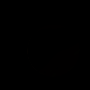 The artist's impression of K2-32 Ad artist's rendition